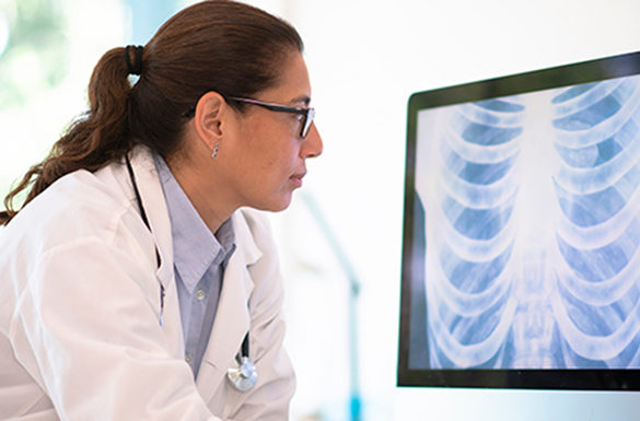 Advances in Treating Non-Small Cell Lung Cancer